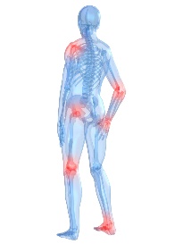 skeleton with arthritis